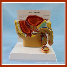 Medical Teaching Male Pelvis Anatomical Model with Common Disease
